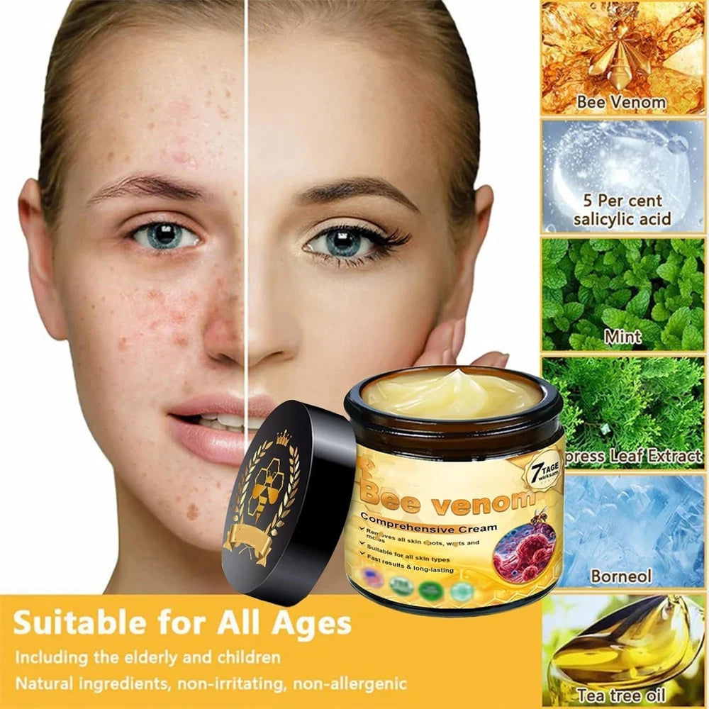 2Pcs Bee Venom Cream, Bee Venom Skin Treatment Cream, Bee Venom Wrinkle Removal