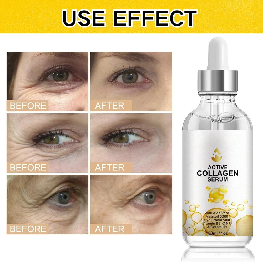 Anti Ageing Serum Wrinkles Skin Plumping Rejuvenating Collagen - Hyaluronic Acid