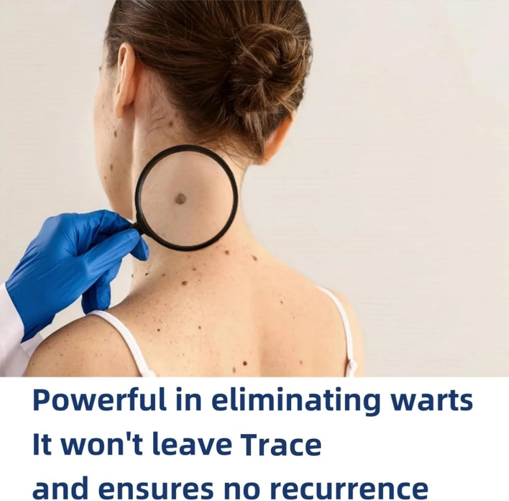 STRONG SKIN TAG REMOVER Cream NATURAL TREATMENT MOLES WARTS and TAGS