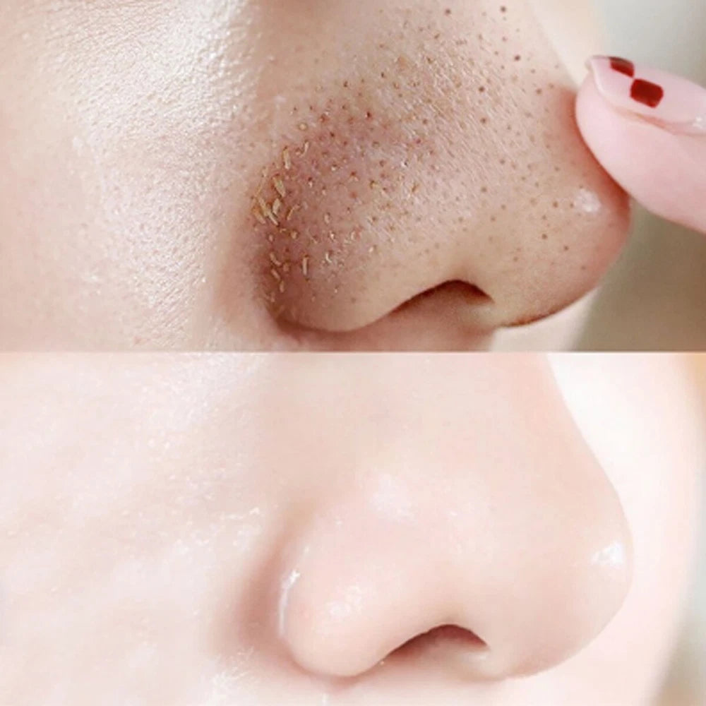 ✅10pcs Nose Pore Strips Blackhead Removal Unclog Pores Smooth Deep Cleansing NEW