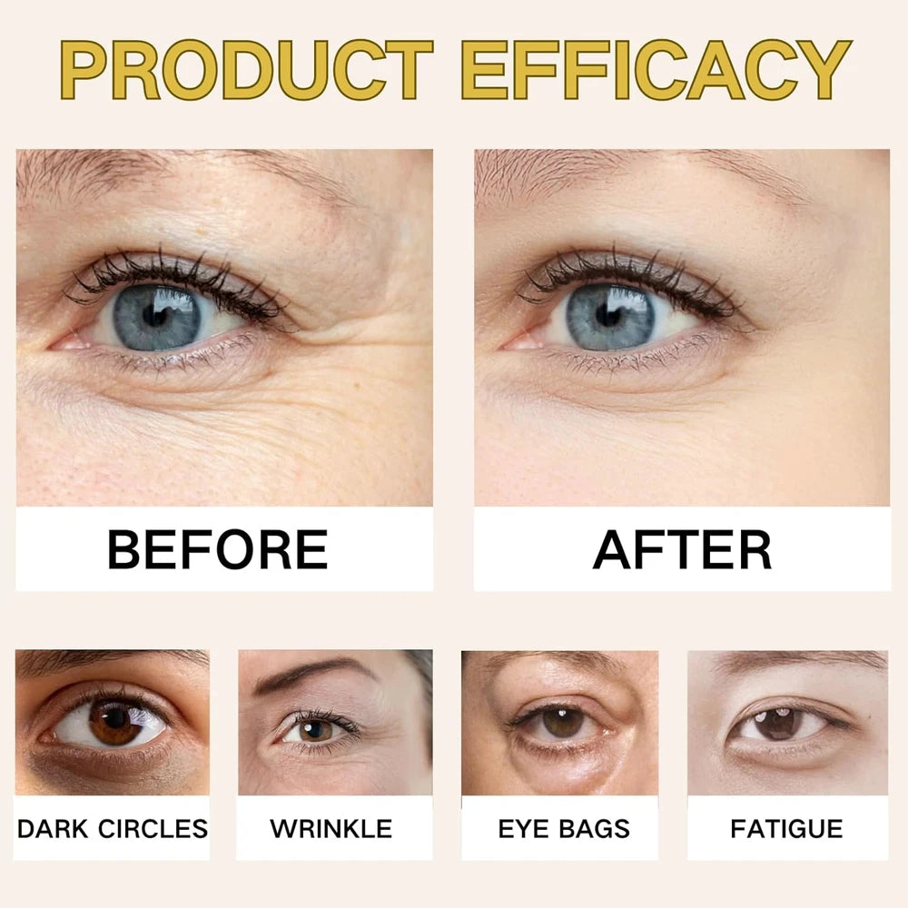 Instant Tightening Eye Cream for Dark Circles & Puffy Eyes - Caffeine Eye Serum,