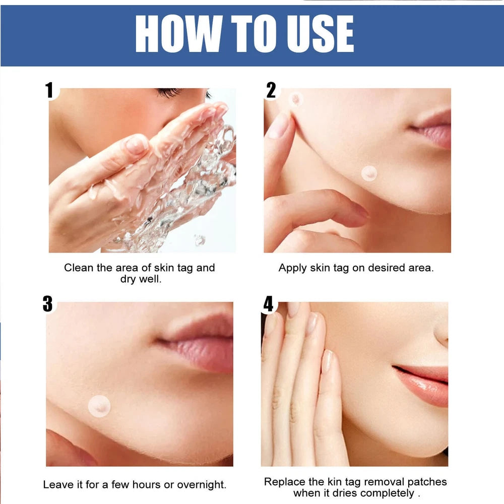 144pcs Skin Tag Remover Patches Quick Effective Mole Wart Removal Pad Sticker UK