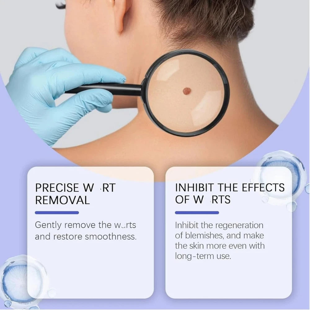 STRONG SKIN TAG REMOVER Cream NATURAL TREATMENT MOLES WARTS and TAGS
