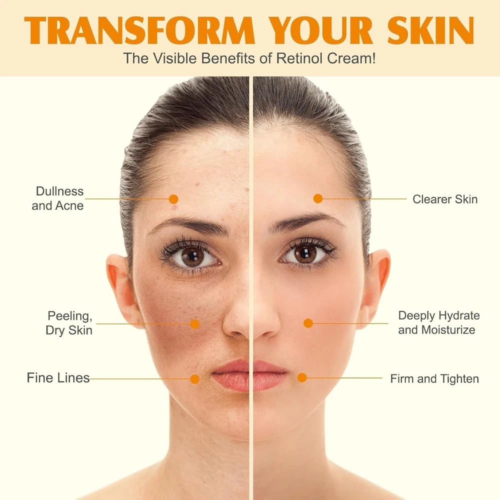 Whipped Tallow Cream - Beef Tallow Skin Care - Tallow and Honey Balm for Face &