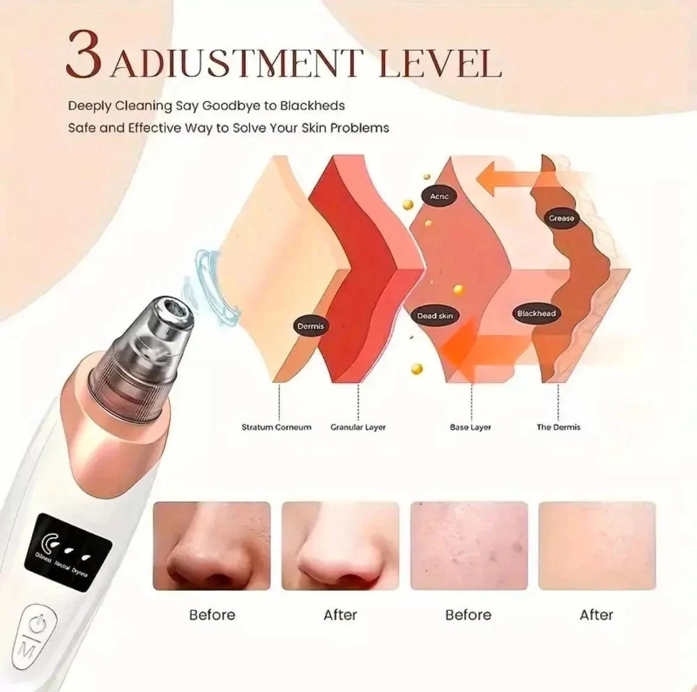 Electric Blackhead Remover Pore Nose Sucker Pimple Skin Acne Face Vacuum cleaner