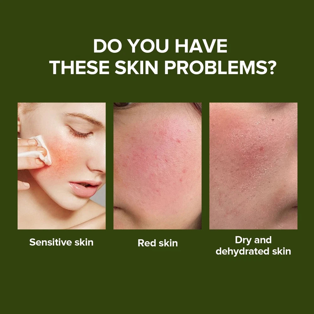 Centella Serum for Fade Spots, even skin tone & Sensinol Control Soothing 30ml