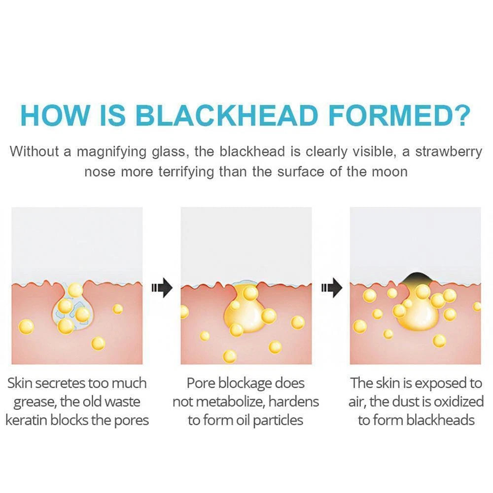 Bamboo Charcoal Blackhead Removal Peel-Off Nose Mask Clean Pores Tool♤