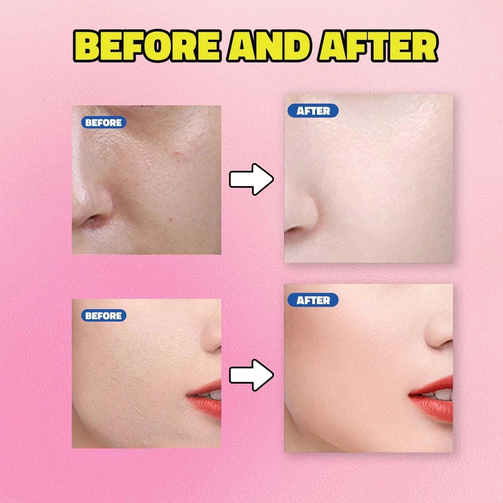 Mandelic Acid + HA Mild Exfoliation Peeling Effect Face Serum 30ml