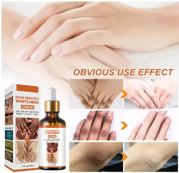 Dark Knuckles Remover From Hand,Dark Spot Correcting Glow Serum,Lightweight Body
