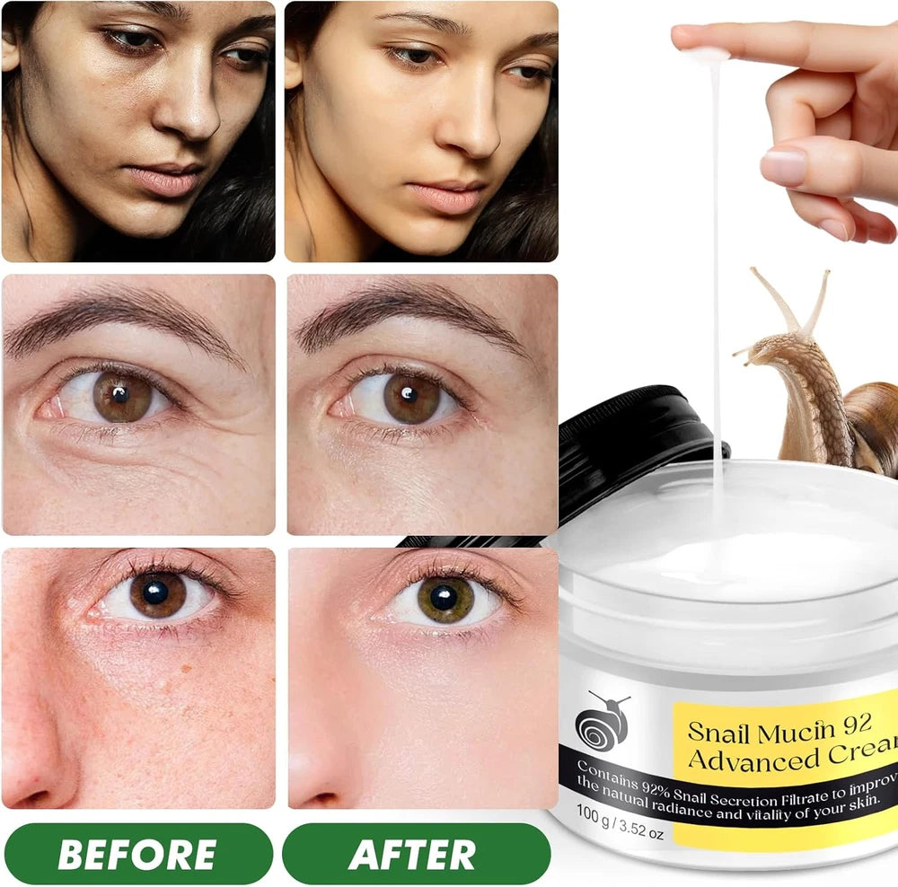 Snail Mucin 92% Face Moisturizer – 3.52 Oz Hydrating & Repairing Cream for Soft,