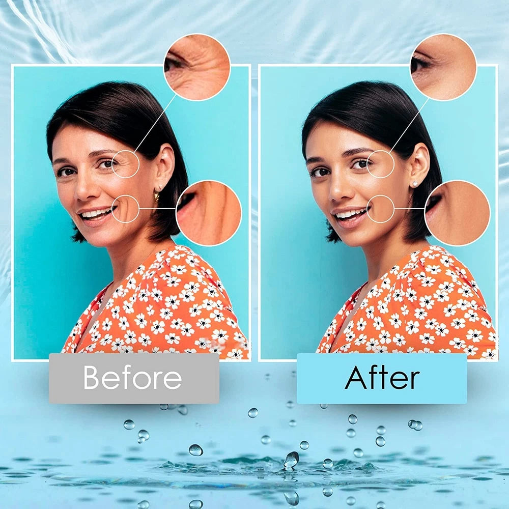 Hyaluronic Acid Anti-aging Serum for Face - 100% Pure Medical Formula - 2oz