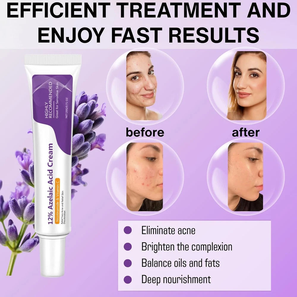 12% Aze-Laic Acid Acne Cream，Acne & Hyperpigmentation Treatment for Spot Prone