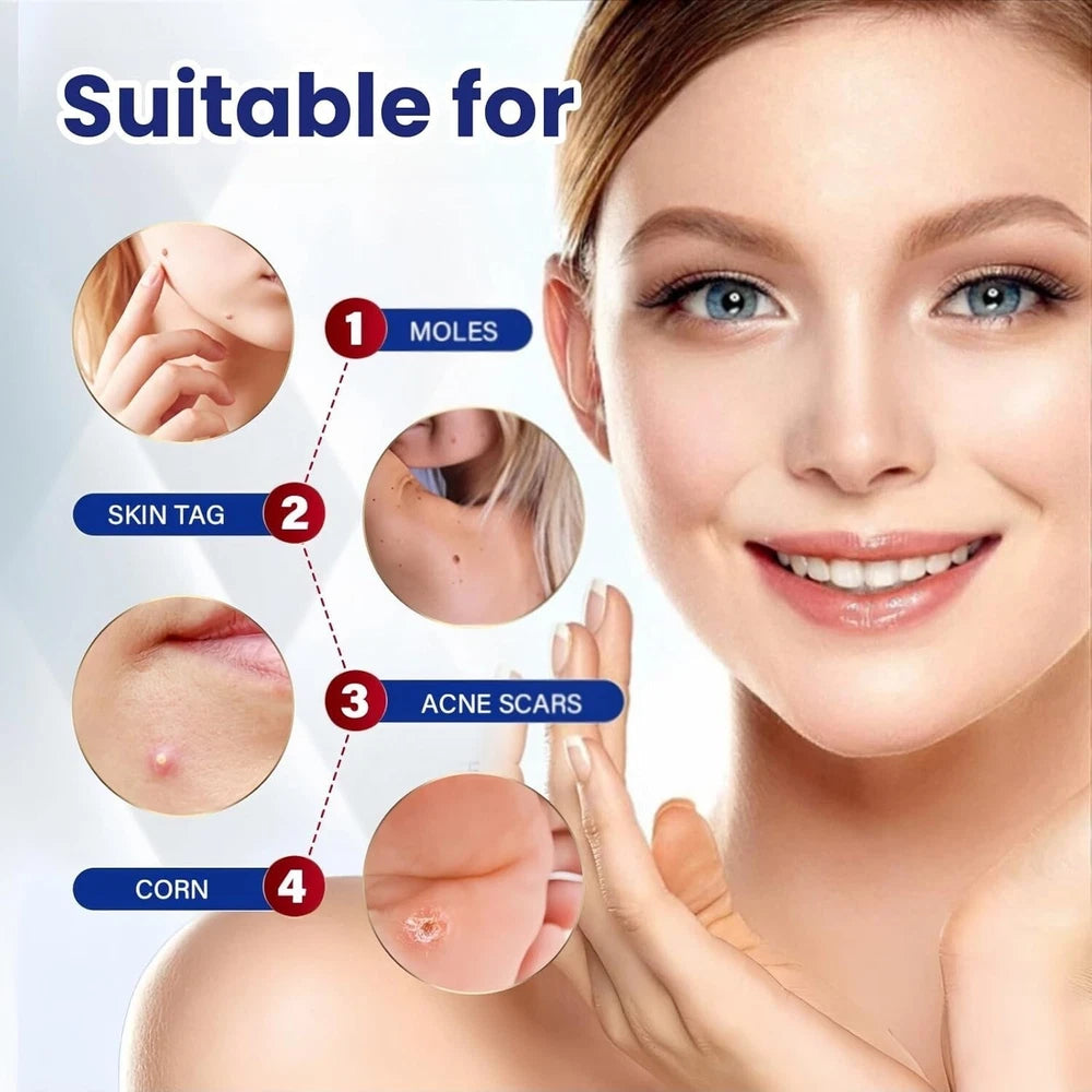 Skin Tag Mole Wart Remover Removal Cream Ointment Fast Safe Natural Treatment