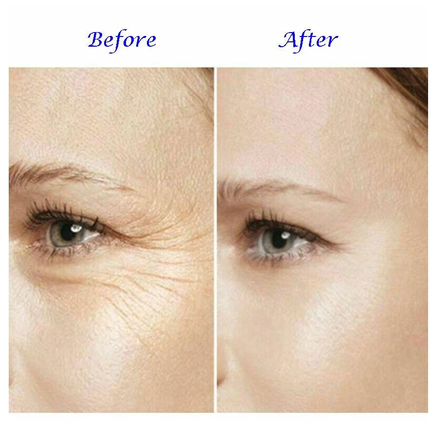 ANTI WRINKLE CREAM, INSTANT FACE LIFT ,FINE LINE CREAM. WORKS INSTANTLY!