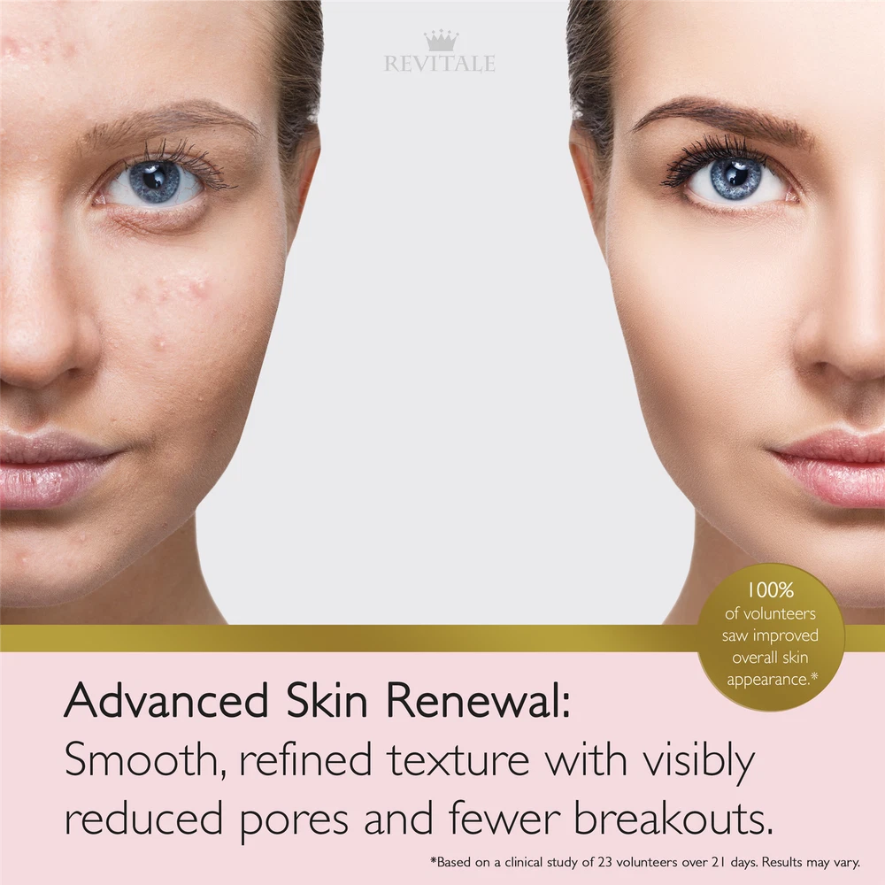 Revitale Advanced Salicylic Acid Cream 80g