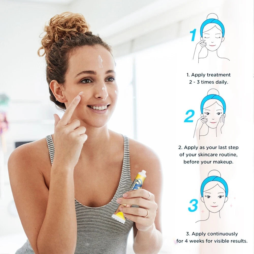 Acne Removal Cream Pimple Pits Pustule Ointment Deep Cleaning Face Repair Skin