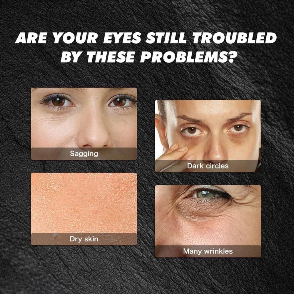 Turmeric Retinol Eye Cream Stick Anti-Ageing Dark Circles Puffiness Wrinkle Care