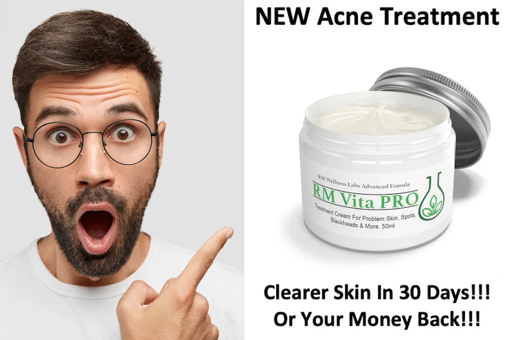 Fast Acting Spots & Acne Treatment Cream Cleanse Blackhead Facial Problem Skin