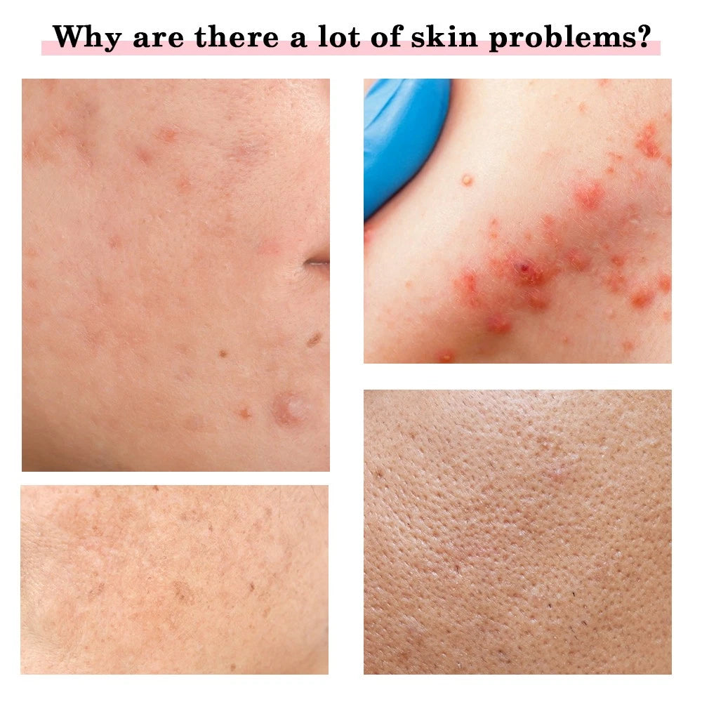 RF Facial Massager Skin Tightening Machine LED Light Photon Therapy Anti-aging