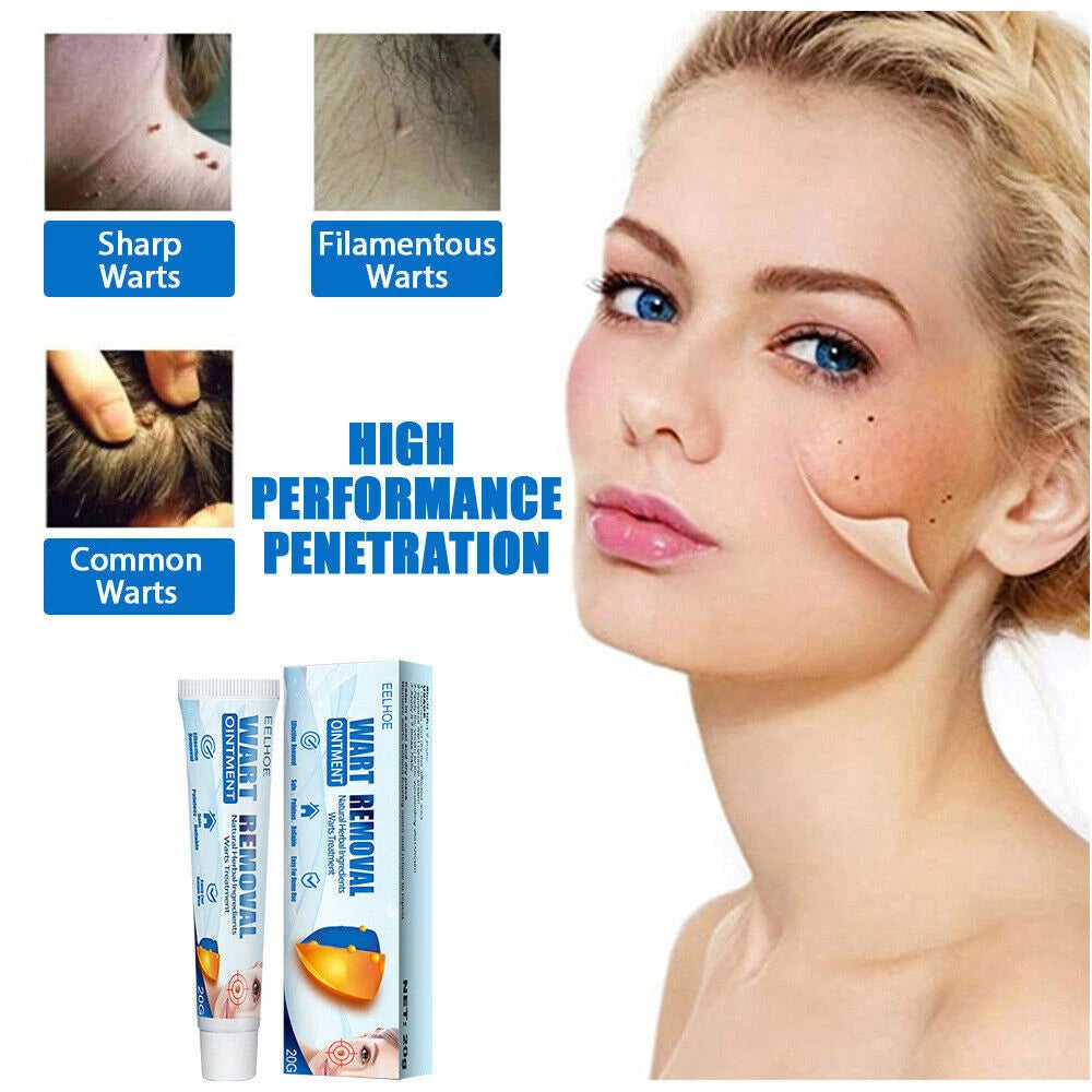 Skin Tag Removal Warts Remover Cream Herbal Ointment Face Body Tag Remover 20g