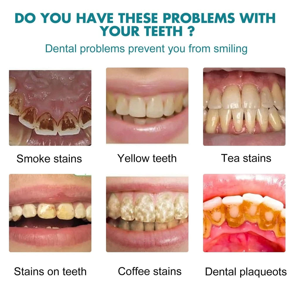 Whitening Tooth Paint,Instant Whitening Paint Teeth,Tooth Polish Uptight White