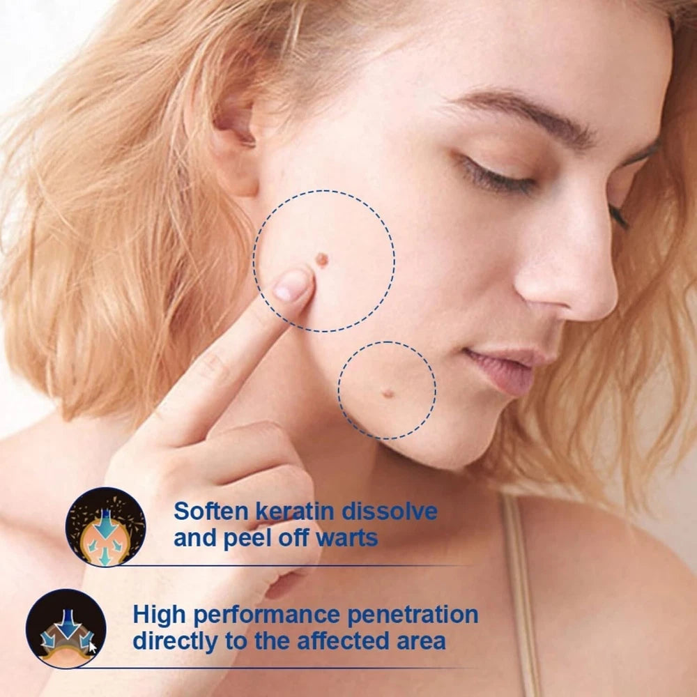 Skin Tag Mole Wart Remover Removal Cream Ointment Fast Safe Natural Treatment