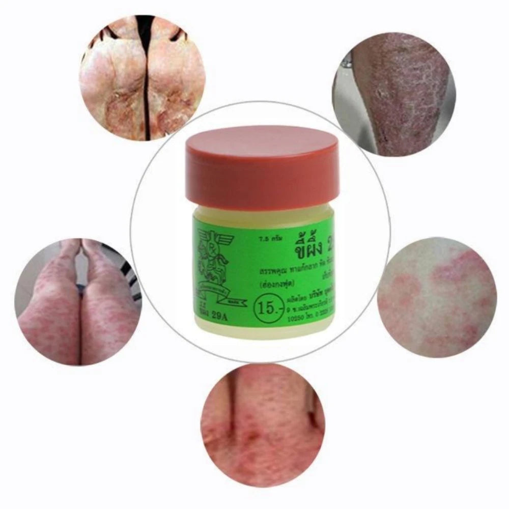 3x Effective Thailand 29A Natural Ointment Psoriasi Eczma Cream and Urticaria
