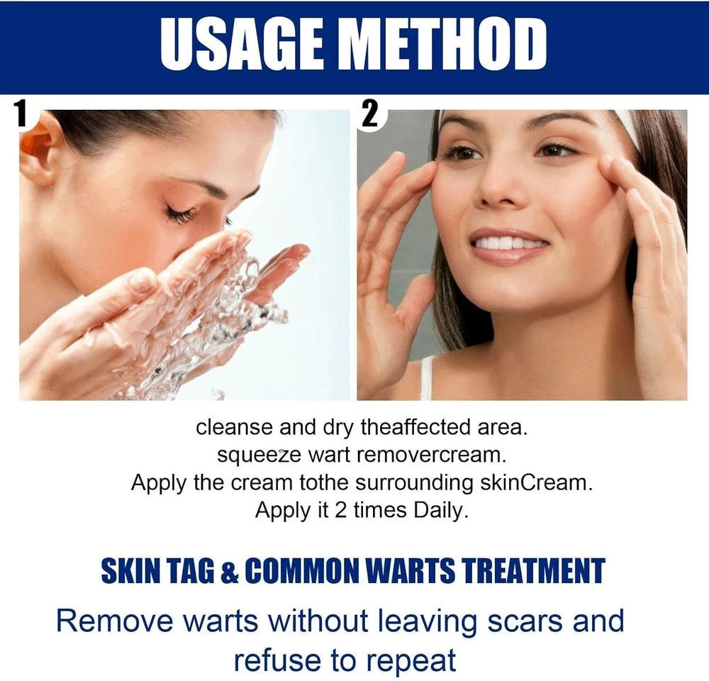 Skin Tag Mole Wart Remover Removal Cream Ointment Fast Safe Natural Treatment