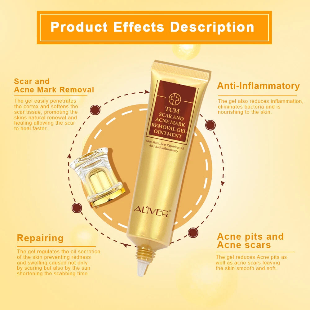 ALIVER Acne Scar Removal Cream Gel Ointment Stretch Cut Burn Spot Mark Treatment