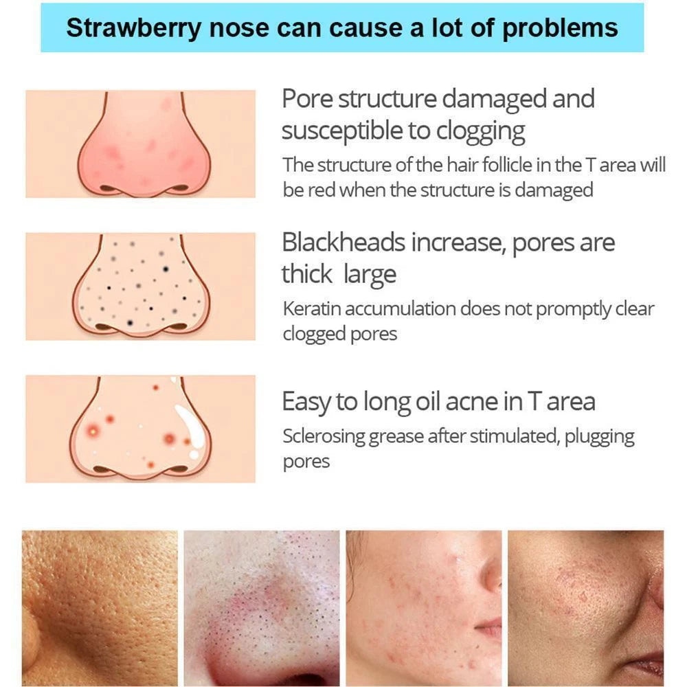 Bamboo Charcoal Blackhead Removal Peel-Off Nose Mask Clean Pores Tool♤