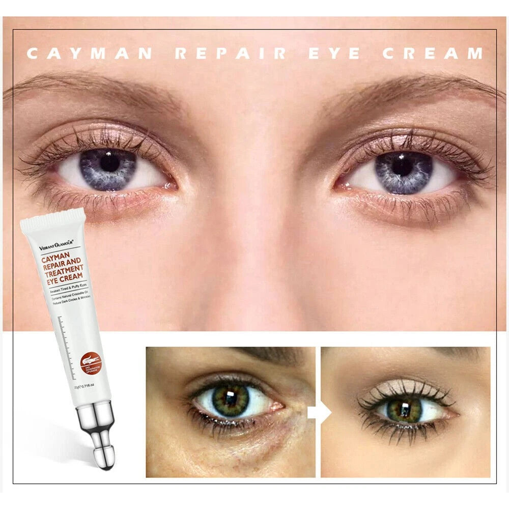 3~Magic Eye Cream for Dark Circles and Puffy Eyes| Under Eye Cream for Women/Men