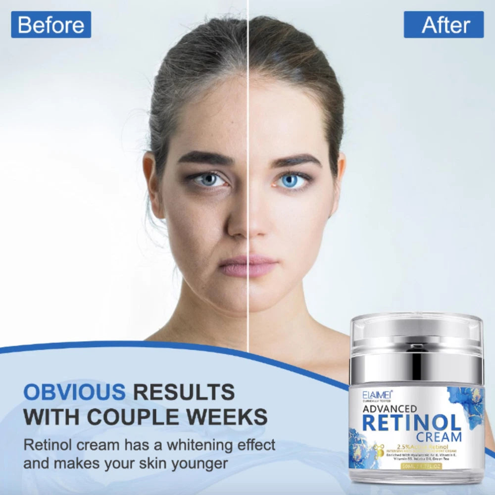 Face Cream Retinol Hyaluronic Acid Vitamin C Anti Aging Wrinkles Blemishes