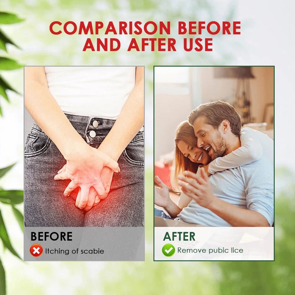 Sumifun Pubic Lice Anti-itch Cream -new