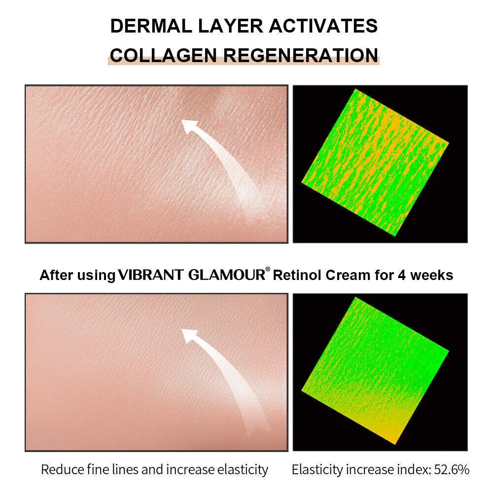 Best 100% Under Eye Cream Retinol, Remove Dark Circles Wrinkles Lines Puffy Eyes