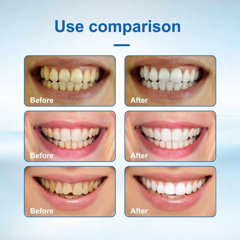 Whitening Tooth Paint,Instant Whitening Paint Teeth,Tooth Polish Uptight White