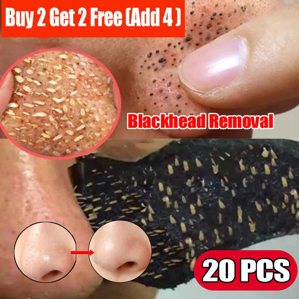 ✅10pcs Nose Pore Strips Blackhead Removal Unclog Pores Smooth Deep Cleansing NEW