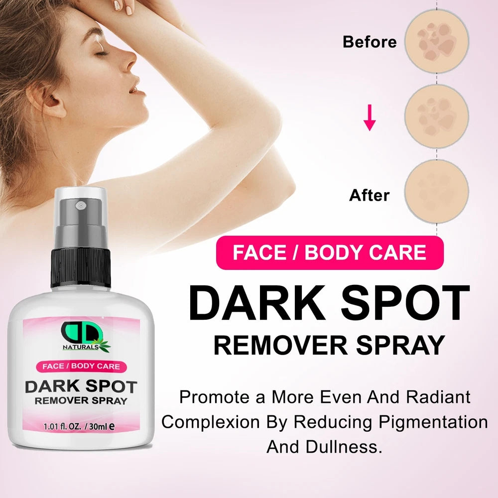 Dark Spot Remover For Fades Dark Spots, Brightens Skin Tone & Reduce Acne