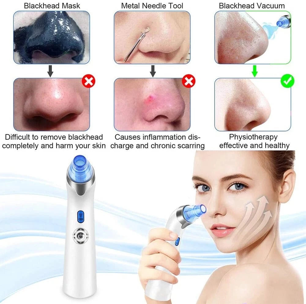 Senelux Blackhead Remover Vacuum Pore Cleaner Acne Comedone Extractor Face Pore