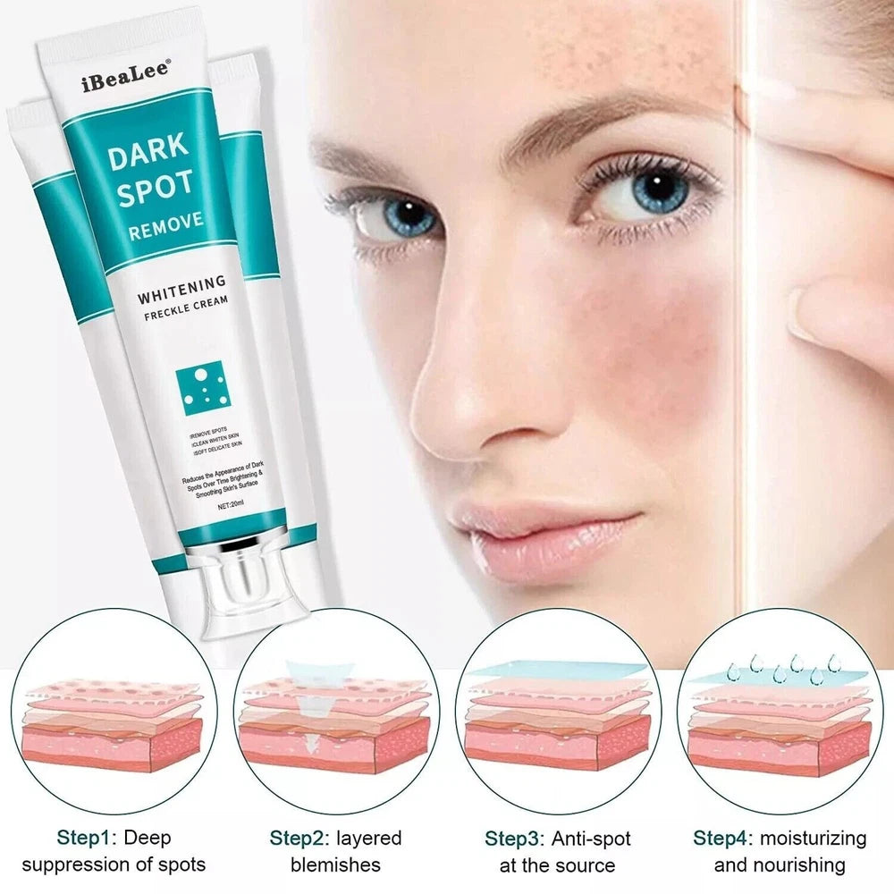 iBeaLee Whitening Freckle Cream Remove Melasma Dark Spots Cream Anti-Aging 20ml