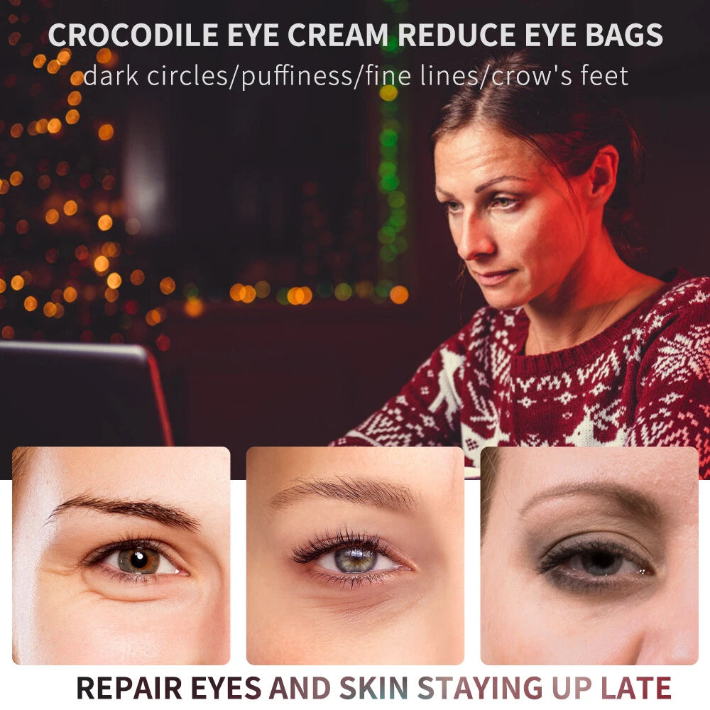 3~Magic Eye Cream for Dark Circles and Puffy Eyes| Under Eye Cream for Women/Men