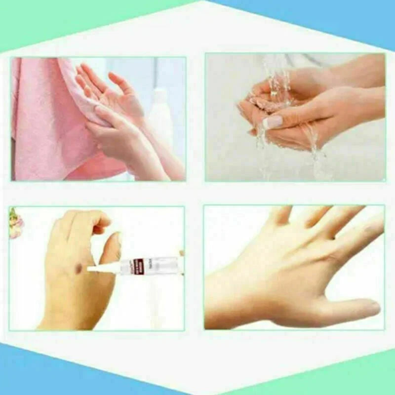 WipeOff™ Skin Tags & Moles Warts Corn Remover - Restore Skin Health and Beauty