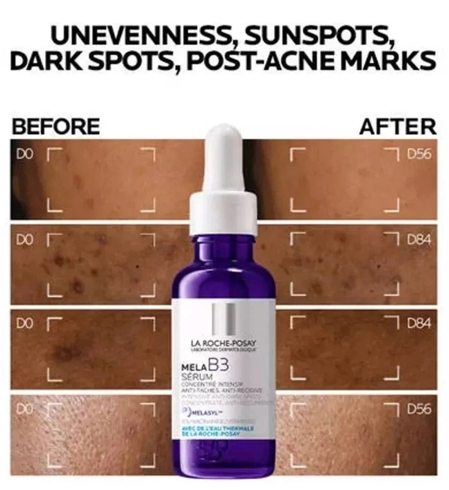 1-3PCS | La-Roche-Posay Mela B3 Dark Spot Serum Melasyl + Niacinamide 30ml UK