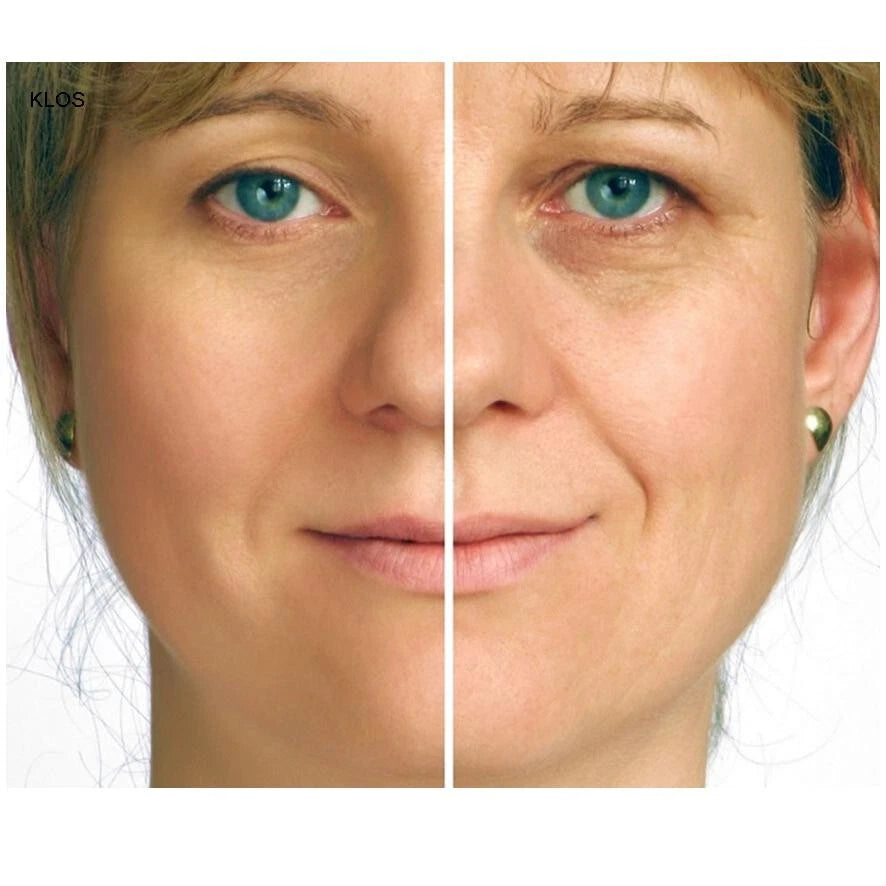 ANTI WRINKLE CREAM, INSTANT FACE LIFT ,FINE LINE CREAM. WORKS INSTANTLY!