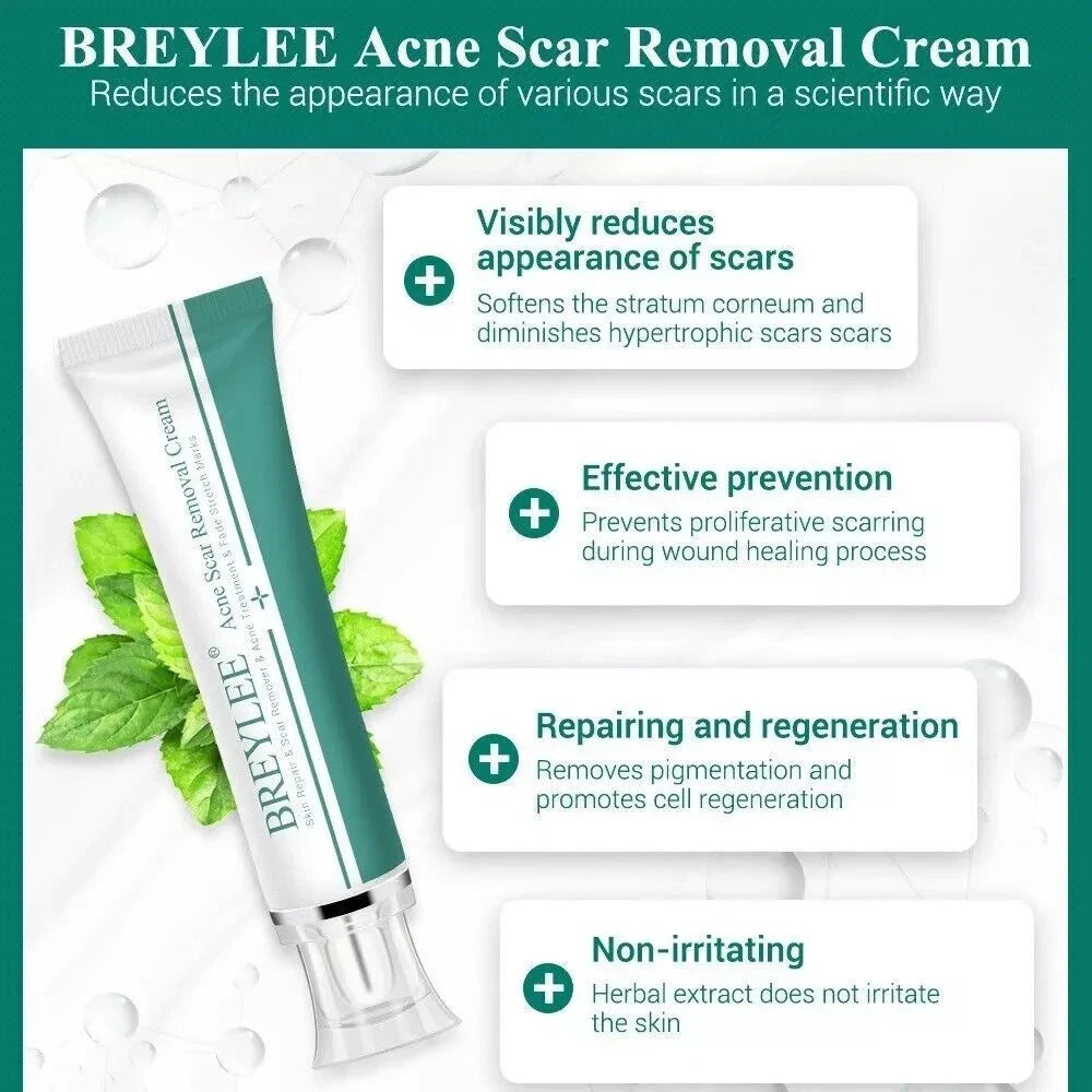 Breylee Acne Scar Removal Cream 30G Face Cream Skin Repair Skin Care Scar Acne