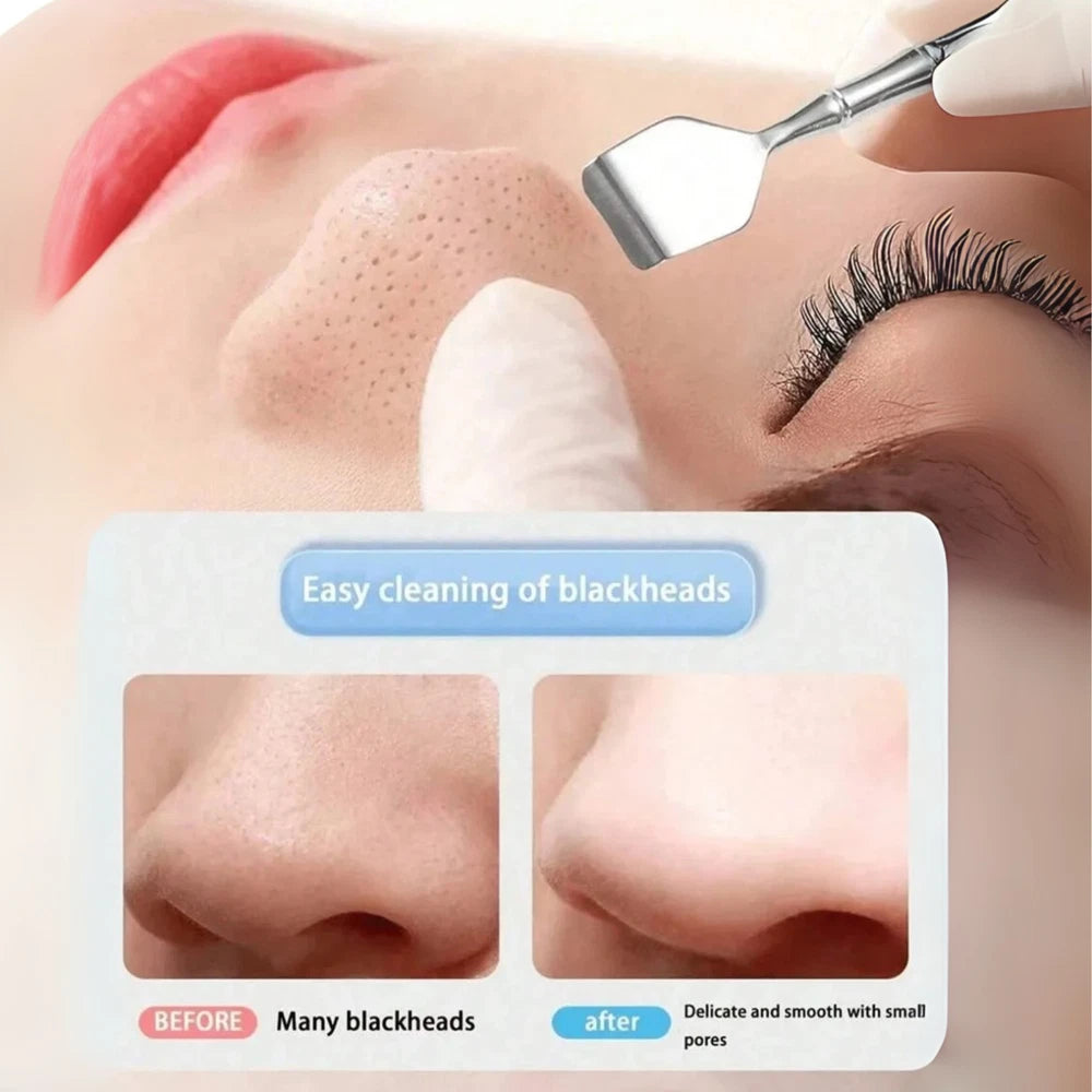 SS Blackhead Remover Deep Cleaning Acne Extractor Tool Comedone Spatula Scraper