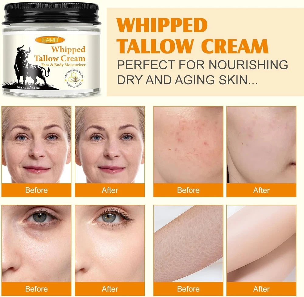 Whipped Tallow Cream - Beef Tallow Skin Care - Tallow and Honey Balm for Face &