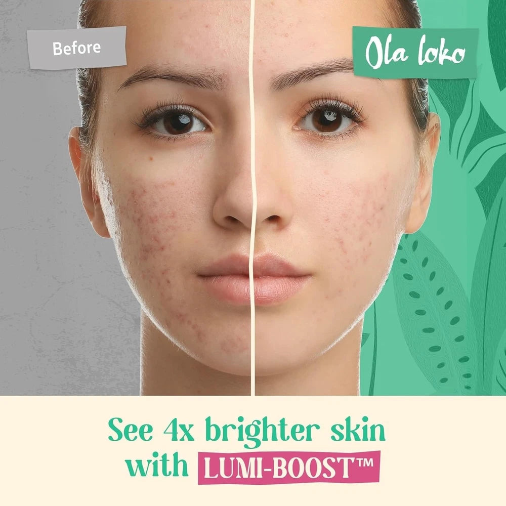 Face Lift Vitamin C Serum with Hyaluronic Acid – Brightening & Anti-Ageing Glow