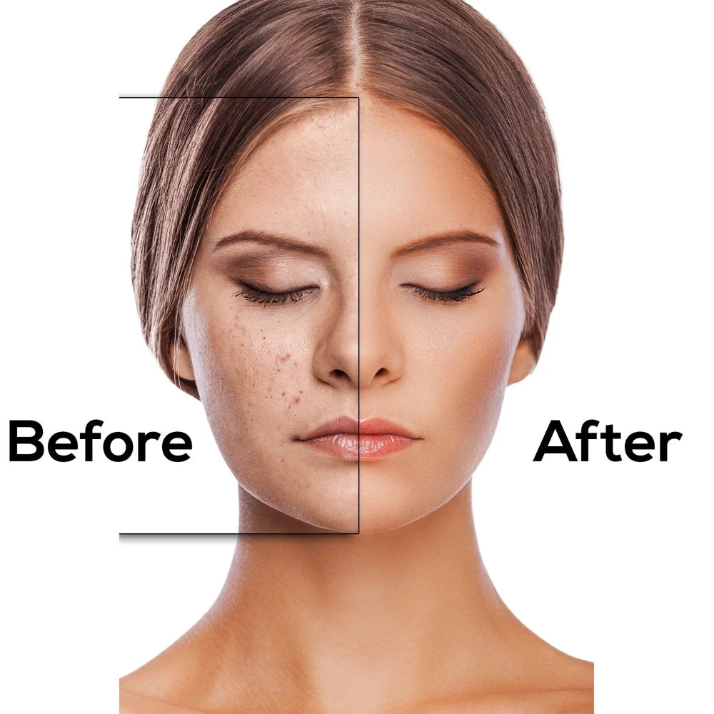 Vitamin C Serum For Face Anti-Aging Organic with Hyaluronic Acid Wrinkle Remover