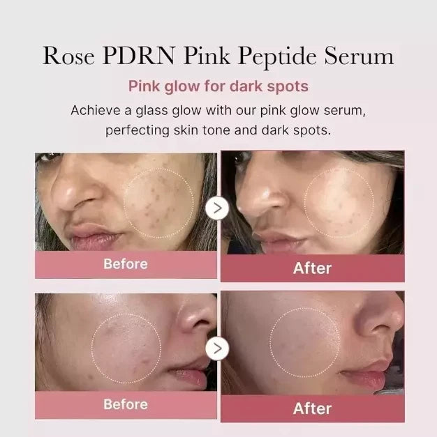 Medicube PDRN Pink Peptide Serum, Niacinamide, Hydrating, Korean Skincare