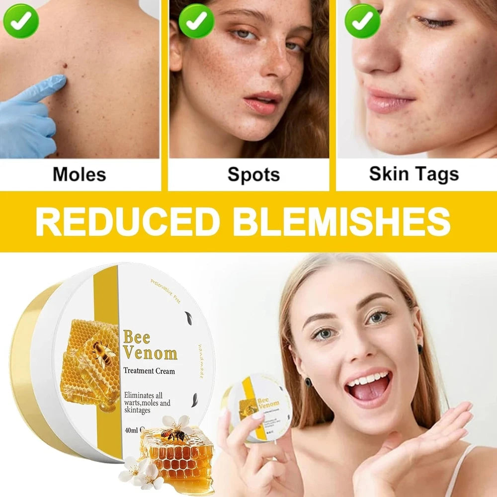 2Pcs Bee Venom Skin Treatment Cream, Bee Venom Cream, Skin Repair, Enric